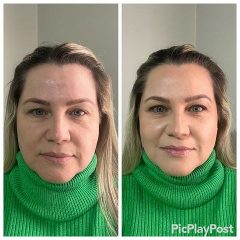Resultado